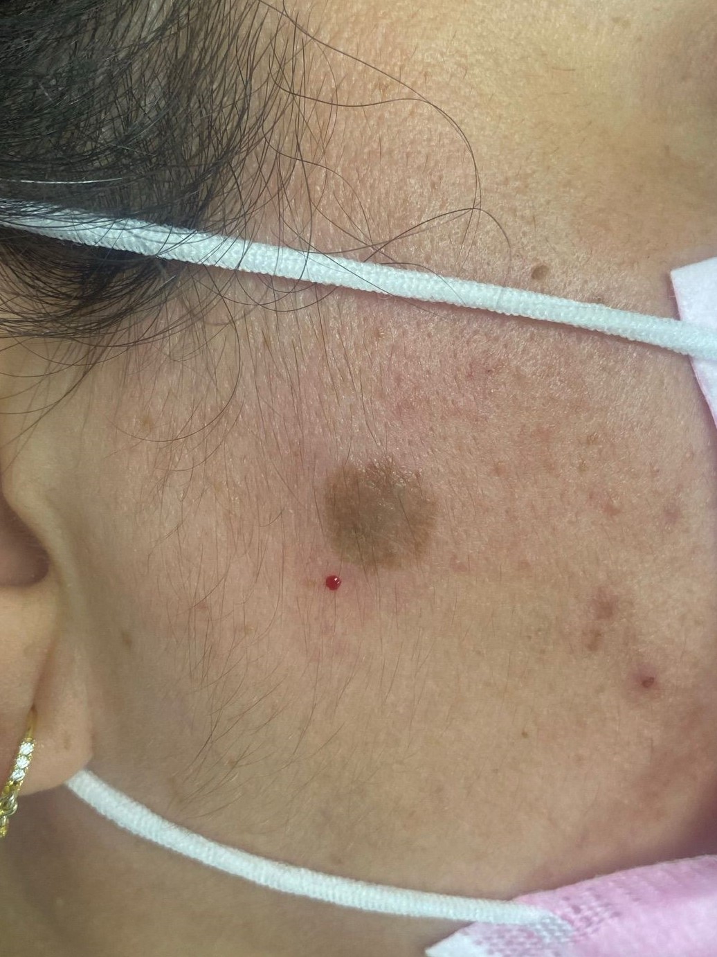 dermatologia murcia