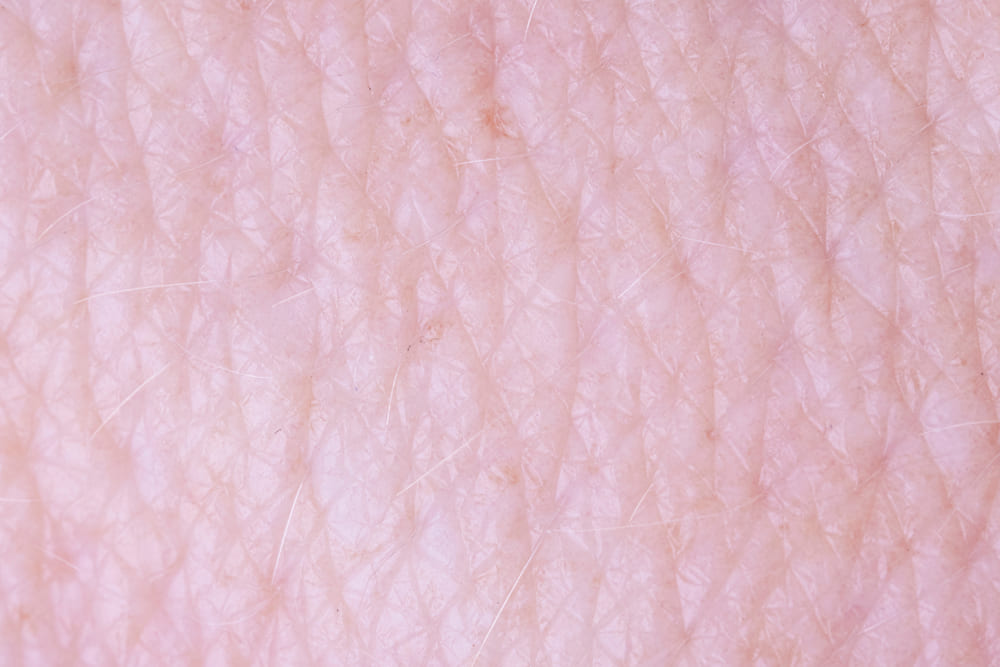 clinica dermatologica murcia