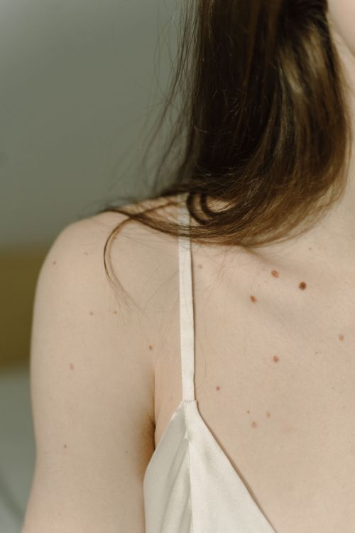 dermatologia murcia