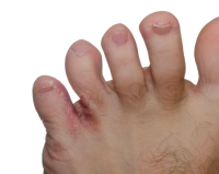 dermatologia murcia
