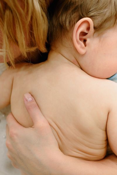 dermatologia murcia