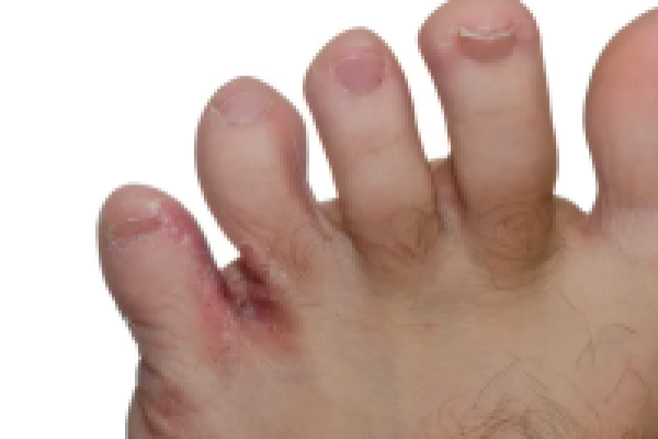 dermatologia murcia